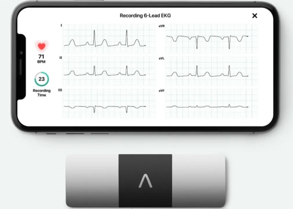 AliveCor KardiaMobile ECG 6 Lead