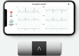 AliveCor KardiaMobile ECG 6 Lead