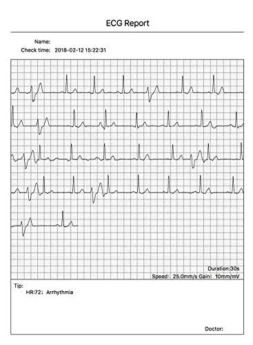 CONTEC Portable ECG/EKG Monitor PC Software Electrocardiogram Bluetooth Heart Rate Beat LCD Monitor PM10