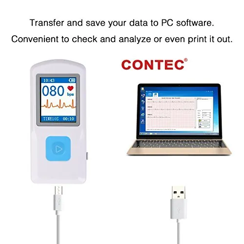 CONTEC Portable ECG/EKG Monitor PC Software Electrocardiogram Bluetooth Heart Rate Beat LCD Monitor PM10